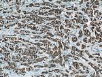 MEK4 Antibody in Immunohistochemistry (Paraffin) (IHC (P))