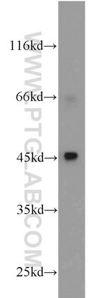 MEK4 Antibody in Western Blot (WB)