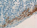 LY6D Antibody in Immunohistochemistry (Paraffin) (IHC (P))