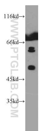 TADA2B Antibody in Western Blot (WB)