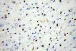 SNRPA1 Antibody in Immunohistochemistry (Paraffin) (IHC (P))