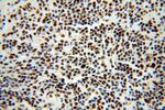 SNRPA1 Antibody in Immunohistochemistry (Paraffin) (IHC (P))