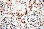 SNRPA1 Antibody in Immunohistochemistry (Paraffin) (IHC (P))