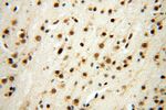 SNRPA1 Antibody in Immunohistochemistry (Paraffin) (IHC (P))