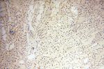 SNRPA1 Antibody in Immunohistochemistry (Paraffin) (IHC (P))