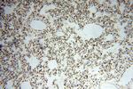 SNRPA1 Antibody in Immunohistochemistry (Paraffin) (IHC (P))