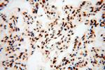 SNRPA1 Antibody in Immunohistochemistry (Paraffin) (IHC (P))