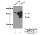 SNRPA1 Antibody in Immunoprecipitation (IP)