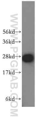 SNRPA1 Antibody in Western Blot (WB)