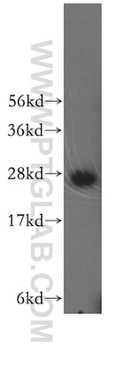 SNRPA1 Antibody in Western Blot (WB)