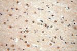 TEX10 Antibody in Immunohistochemistry (Paraffin) (IHC (P))