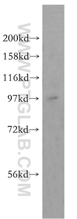 TEX10 Antibody in Western Blot (WB)