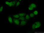 PADI4 Antibody in Immunocytochemistry (ICC/IF)