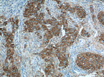 PADI4 Antibody in Immunohistochemistry (Paraffin) (IHC (P))