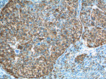 PADI4 Antibody in Immunohistochemistry (Paraffin) (IHC (P))