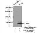 PADI4 Antibody in Immunoprecipitation (IP)