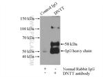 DNTT/TDT Antibody in Immunoprecipitation (IP)
