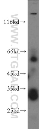 PIGZ Antibody in Western Blot (WB)