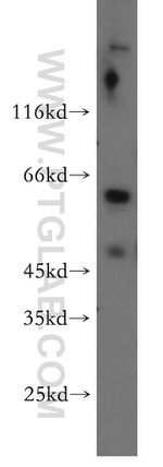 PIGZ Antibody in Western Blot (WB)