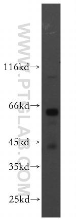 PIGZ Antibody in Western Blot (WB)