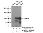 ALDH1L1 Antibody in Immunoprecipitation (IP)