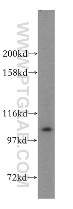 AlaRS Antibody in Western Blot (WB)