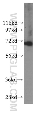 RPAP2 Antibody in Western Blot (WB)