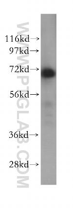 RPAP2 Antibody in Western Blot (WB)