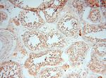 PDCL2 Antibody in Immunohistochemistry (Paraffin) (IHC (P))