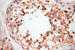 PDCL2 Antibody in Immunohistochemistry (Paraffin) (IHC (P))