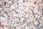 PDCL2 Antibody in Immunohistochemistry (Paraffin) (IHC (P))