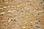 EVI2A Antibody in Immunohistochemistry (Paraffin) (IHC (P))