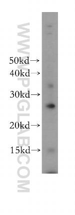 EVI2A Antibody in Western Blot (WB)