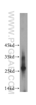 EVI2A Antibody in Western Blot (WB)