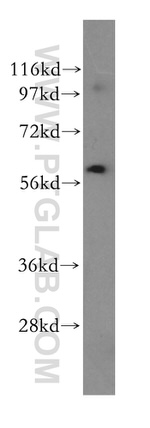 UTP15 Antibody in Western Blot (WB)