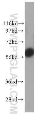 UTP15 Antibody in Western Blot (WB)