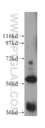 UTP15 Antibody in Western Blot (WB)