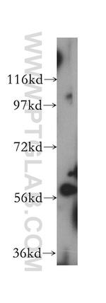 UTP15 Antibody in Western Blot (WB)