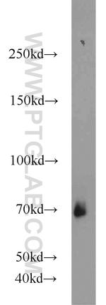 CSGALNACT2 Antibody in Western Blot (WB)