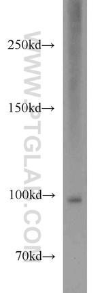 NARG1L Antibody in Western Blot (WB)