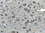 MAGT1 Antibody in Immunohistochemistry (Paraffin) (IHC (P))