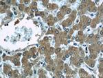 MAGT1 Antibody in Immunohistochemistry (Paraffin) (IHC (P))