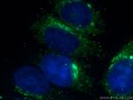 Transferrin Antibody in Immunocytochemistry (ICC/IF)