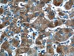 Transferrin Antibody in Immunohistochemistry (Paraffin) (IHC (P))