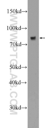 Transferrin Antibody in Western Blot (WB)