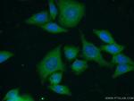 Leptin Antibody in Immunocytochemistry (ICC/IF)