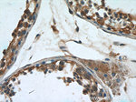 Leptin Antibody in Immunohistochemistry (Paraffin) (IHC (P))