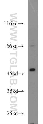 ACADL Antibody in Western Blot (WB)