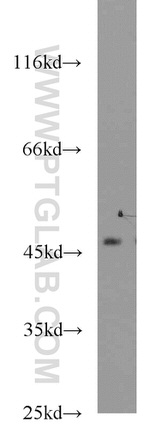 ACADL Antibody in Western Blot (WB)