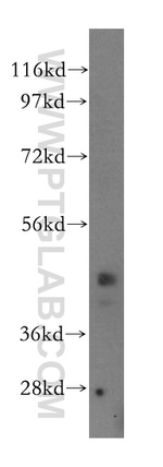 ACADL Antibody in Western Blot (WB)